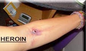 Narcotics collected unique pic -07.