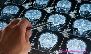 Analysis of Abasement or, Depression By Different Tests, Collected Unique Picture No-008.....